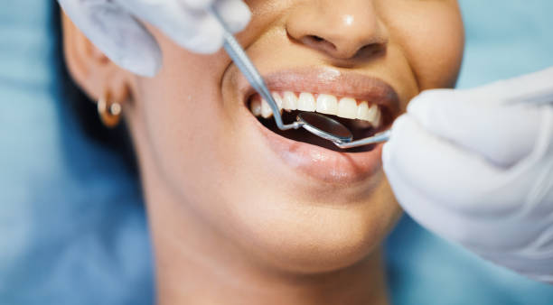 Best Cosmetic Emergency Dentistry in Chehalis, WA